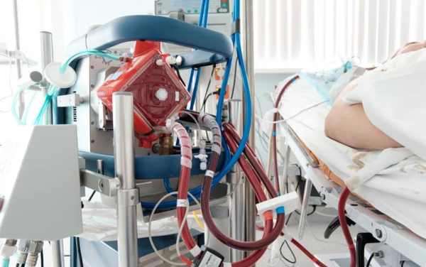 熱點 | 填補國產(chǎn)空白，ECMO迎來“中國造”